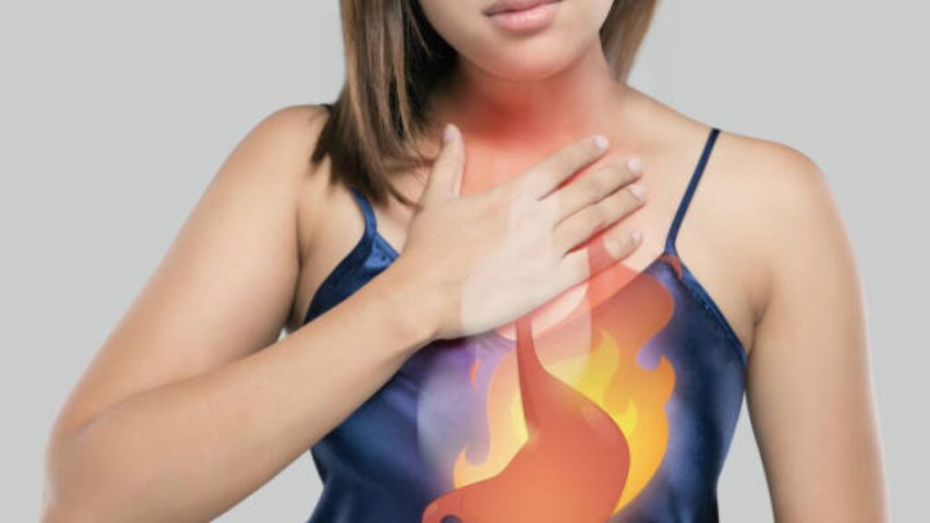 How Sleeping Position Affects Acid Reflux: Avoid These Habits to Prevent Heartburn 1 How sleeping position affects acid reflux