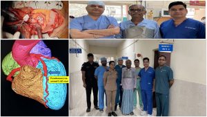 AICTS Pune doctors successfully treat four patients with ultra-rare coronary stent infections